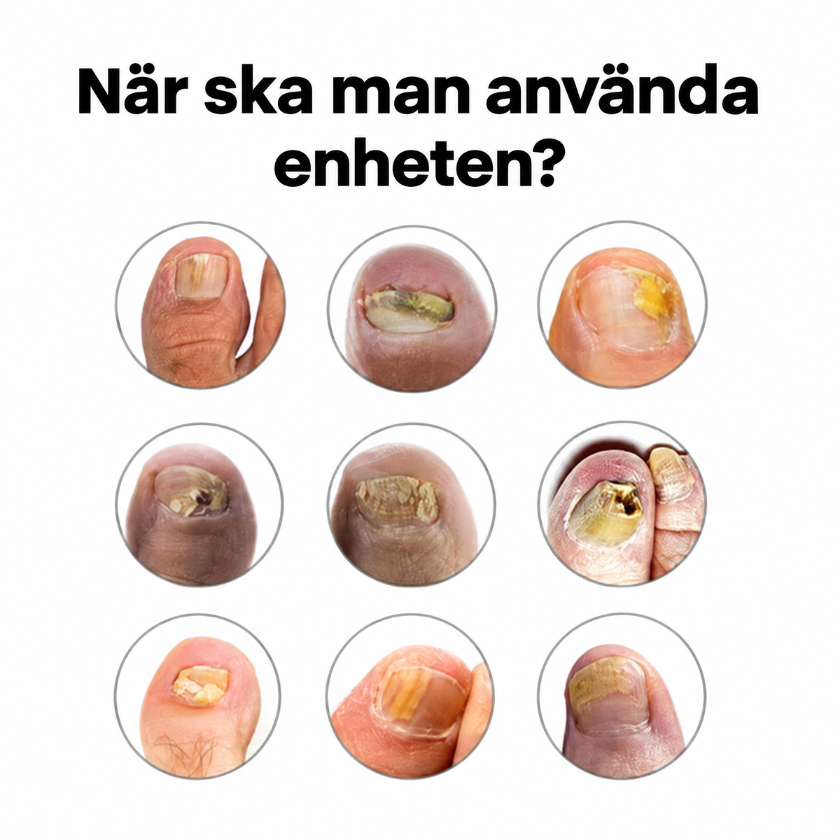 Zivex ClearNail™